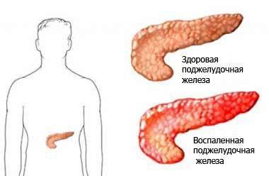 Диета 5п при панкреатите: меню на неделю, правила, результаты